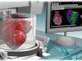 Bioprinting-Heart